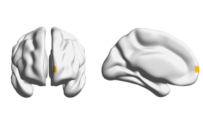 Image of brain from front and side