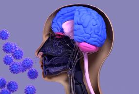 graphic depicting an x-ray type photo of a human brain